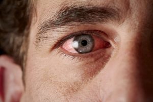 Lire la suite à propos de l’article Œil rouge : dangers, causes et traitements